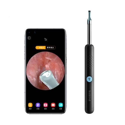 Bebird R1 Wireless Intelligent Visual Otoscope Ear Cleaner by DailySale