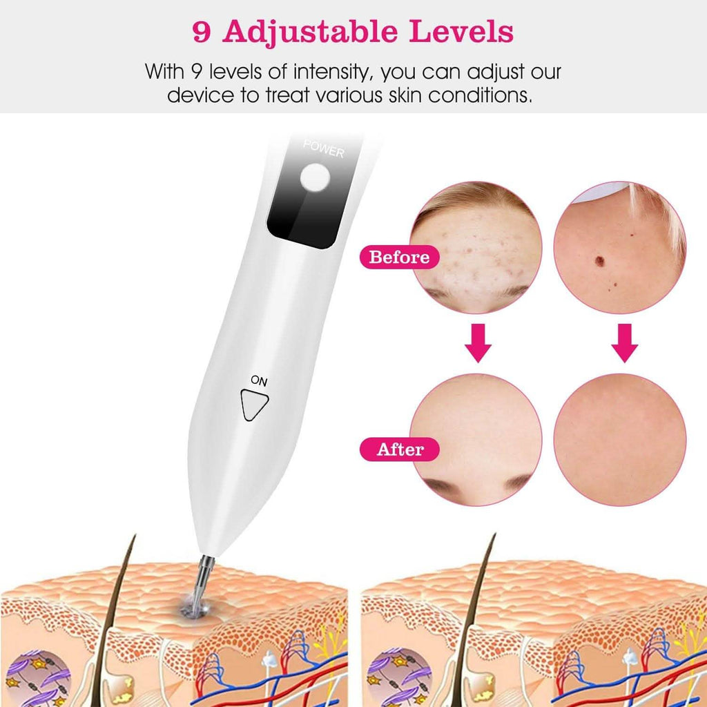 Portable Skin Tag Repair Kit with 6 Replaceable Needles by DailySale