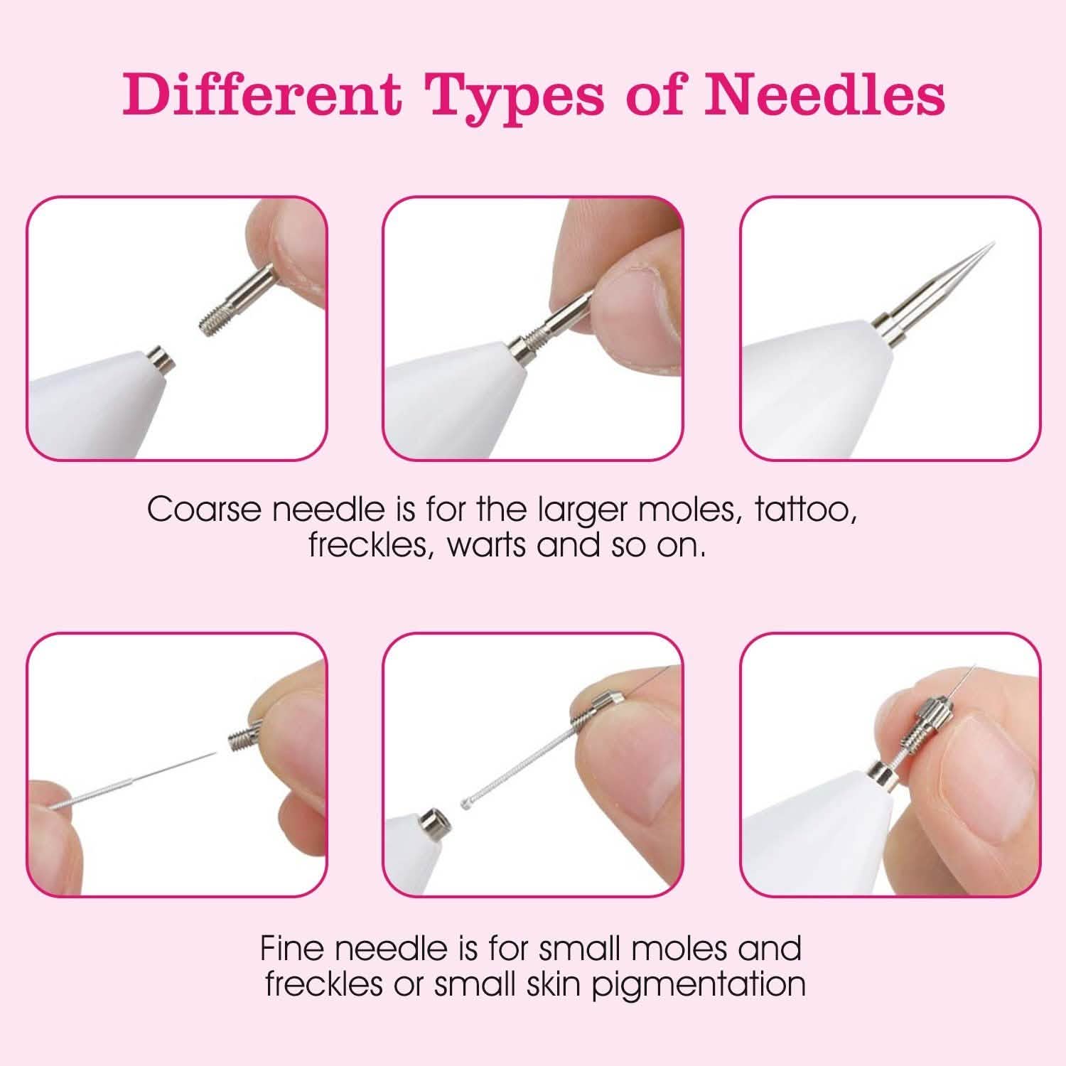 Portable Skin Tag Repair Kit with 6 Replaceable Needles by DailySale