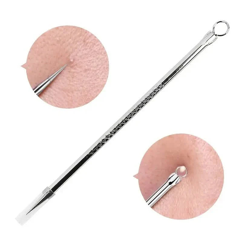 Stainless Steel Pimple Extractor Blackhead Removal Tool For Blemish Whitehead Popping Acne by DailySale